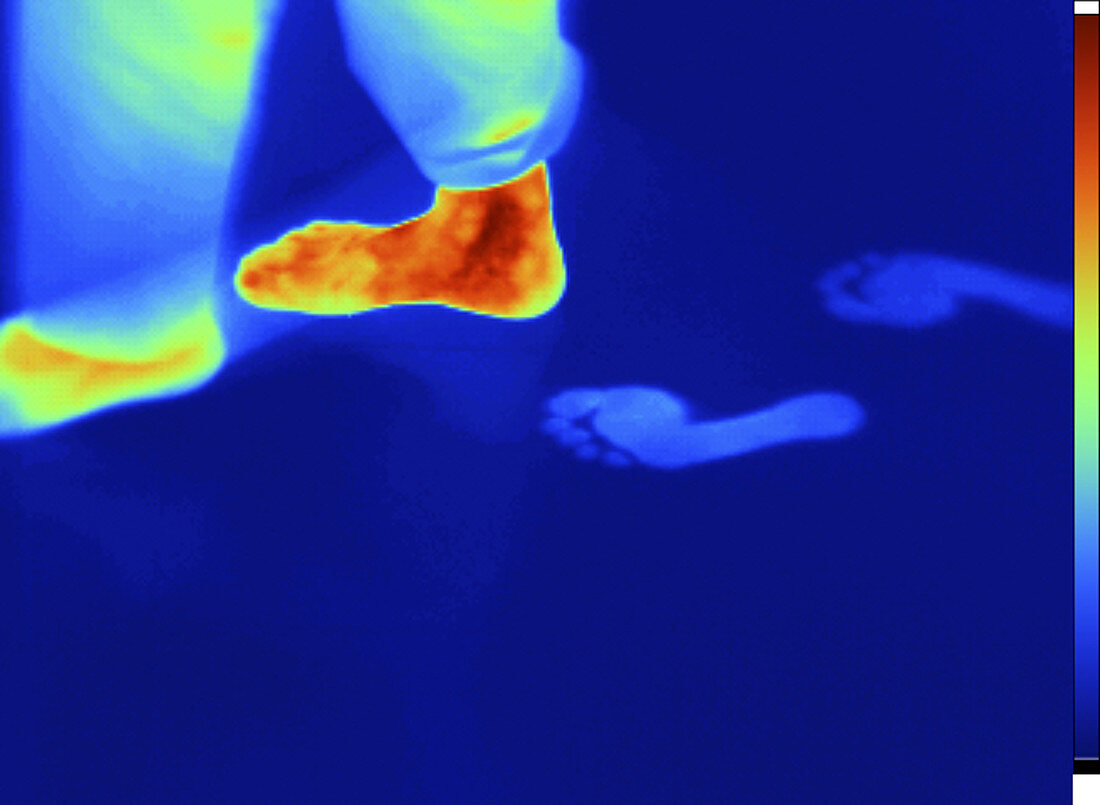 Thermogram of thermal footprints