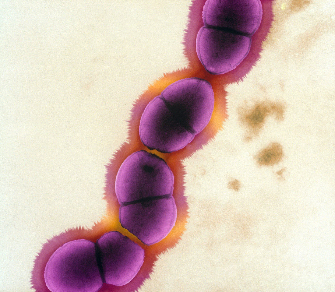 Enterococcus faecalis,TEM
