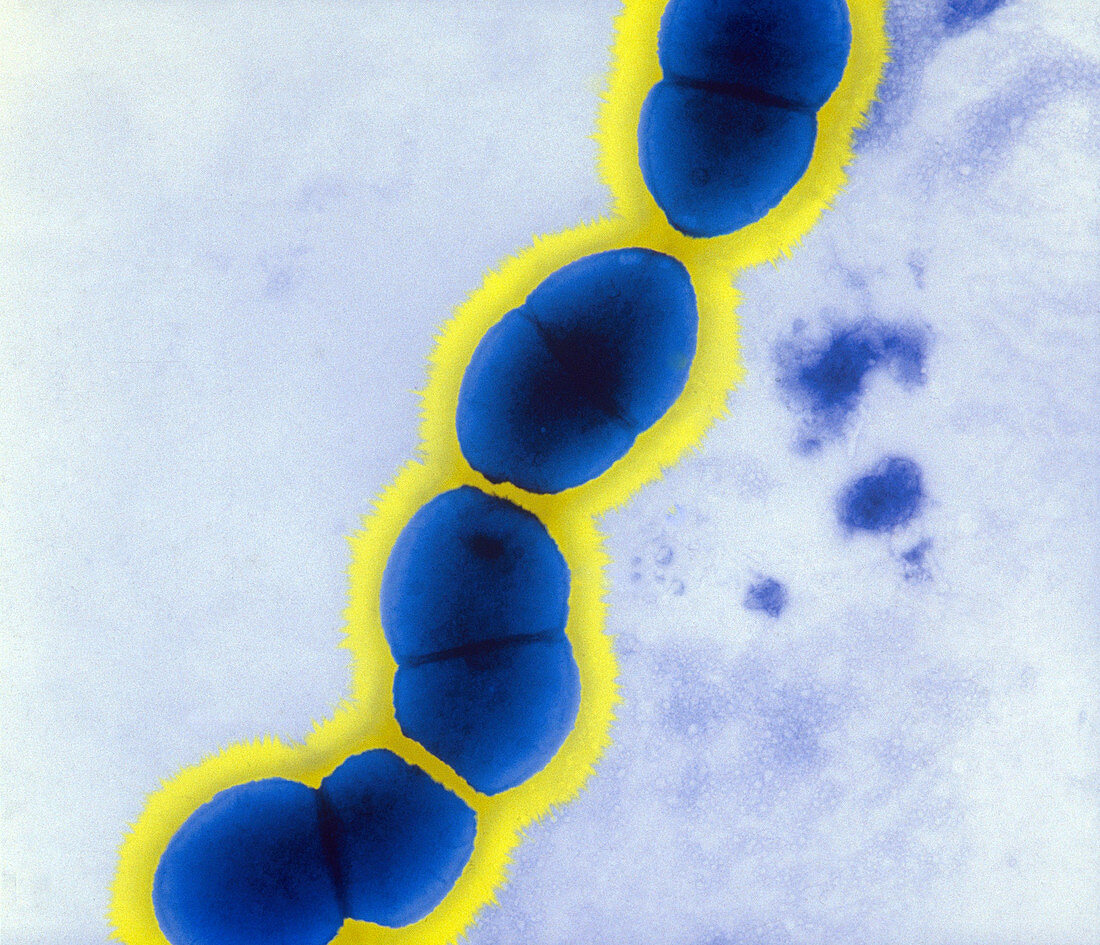 Enterococcus faecalis,TEM