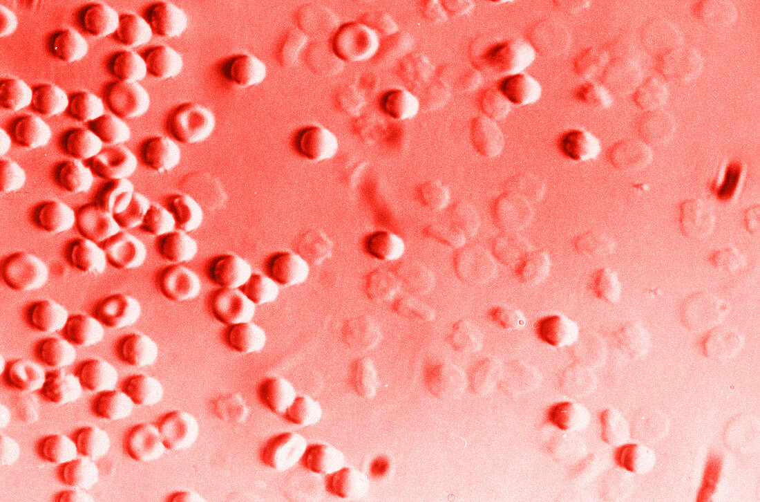 Red Blood Cells in Hypotonic Saline