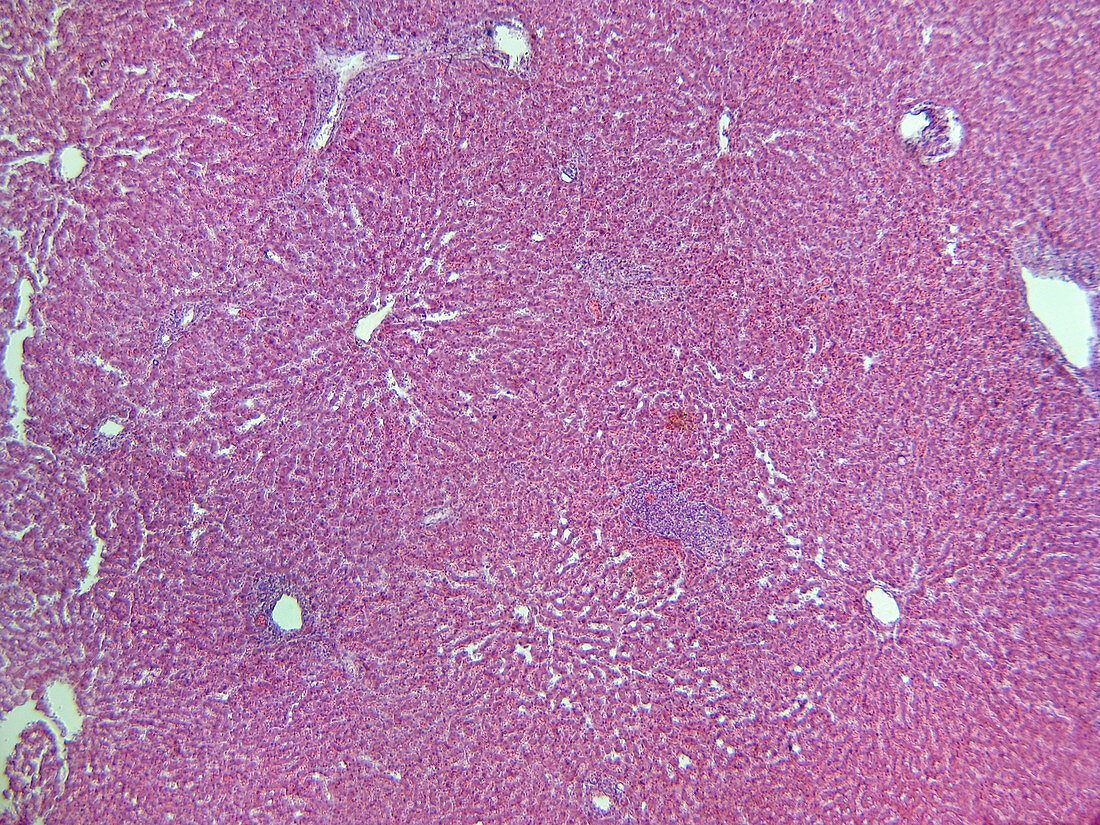 LM of Liver Tissue