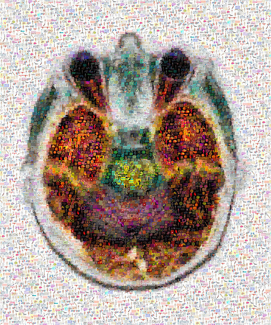 Mosaic of Brain MRI