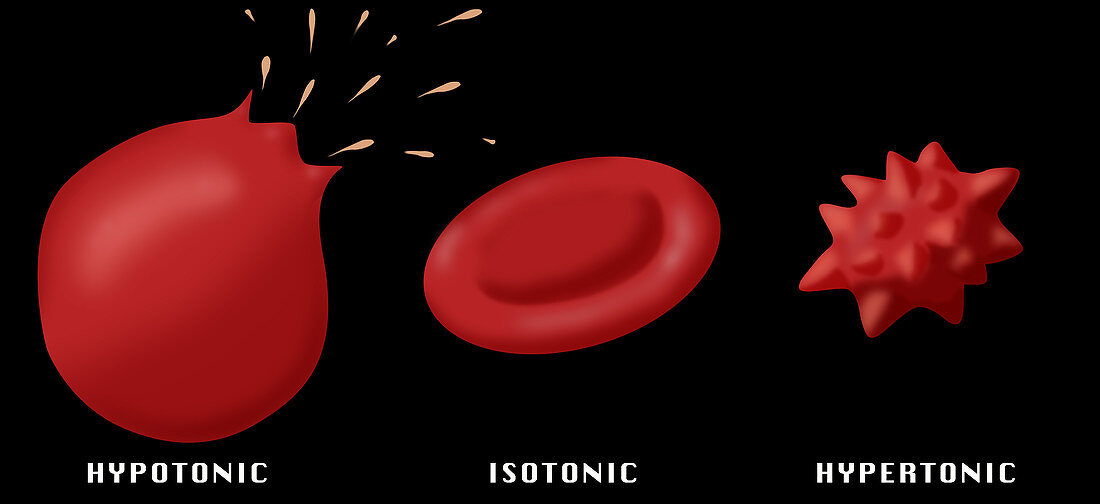 Osmotic Pressure on Blood Cells