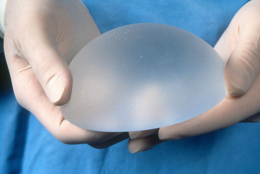 Smooth Saline Filled Mammary Implant