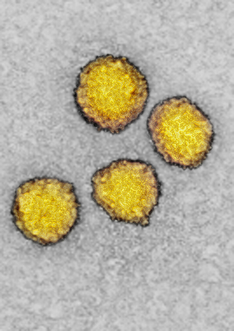 TEM of Hepatitis C Virus