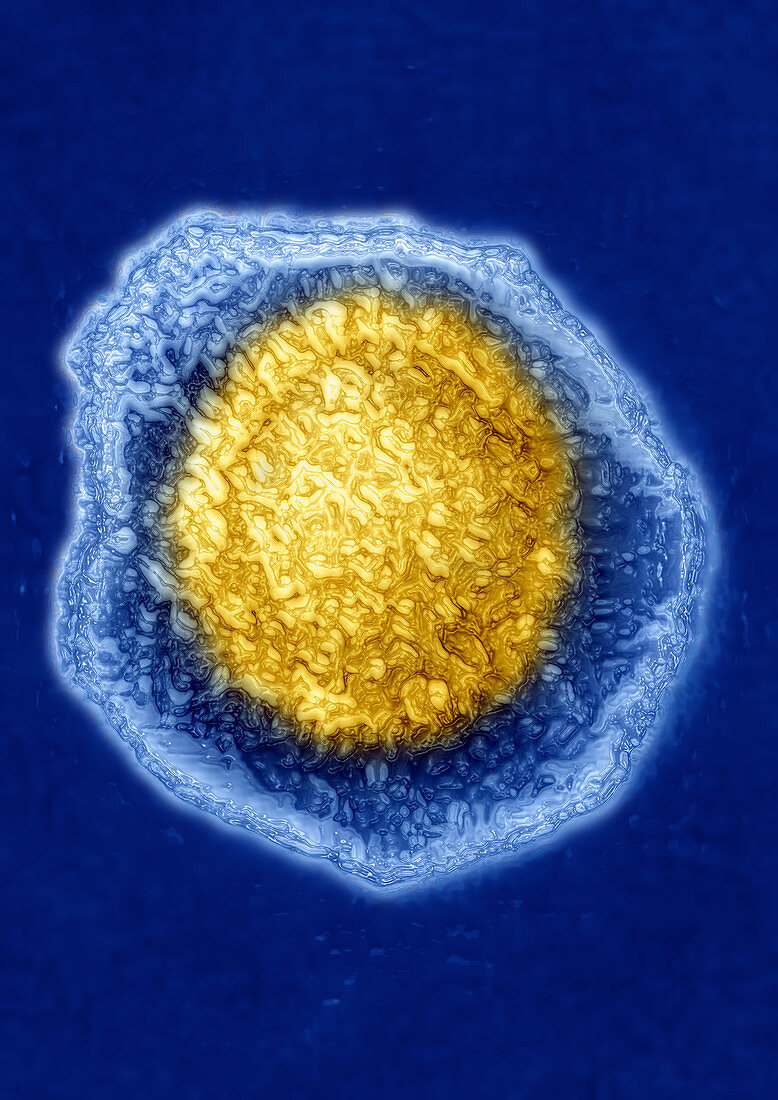TEM of Herpes Simplex Virus