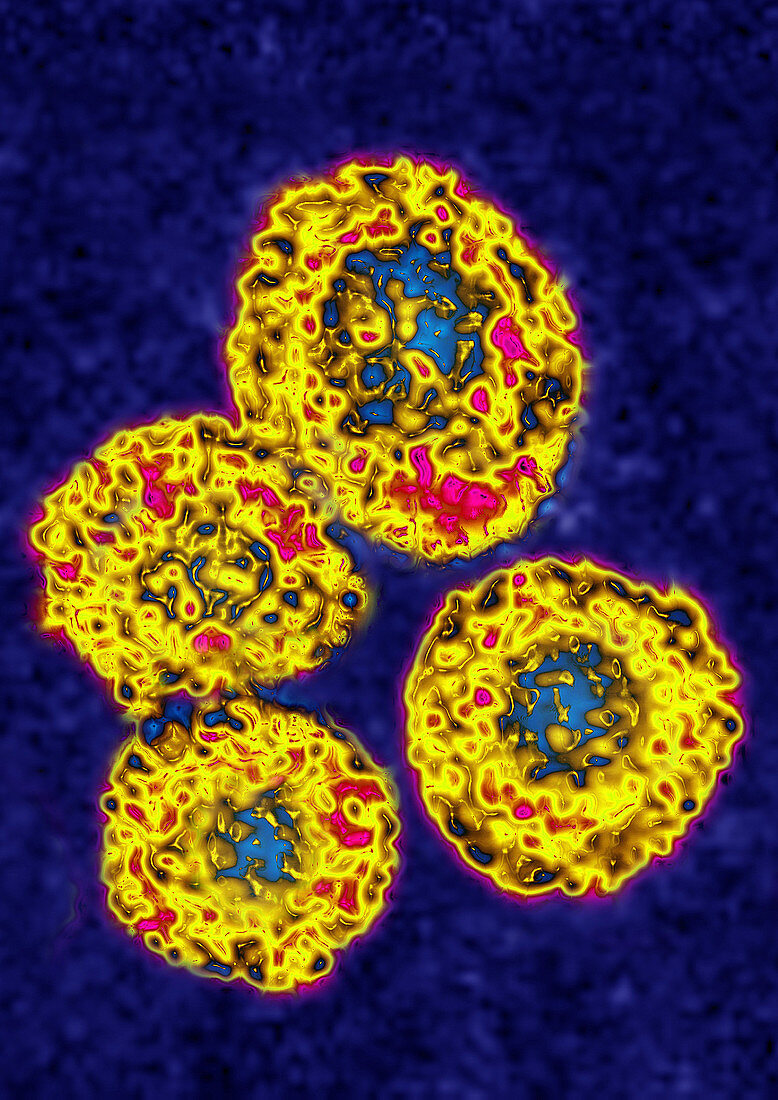 TEM of Rubivirus