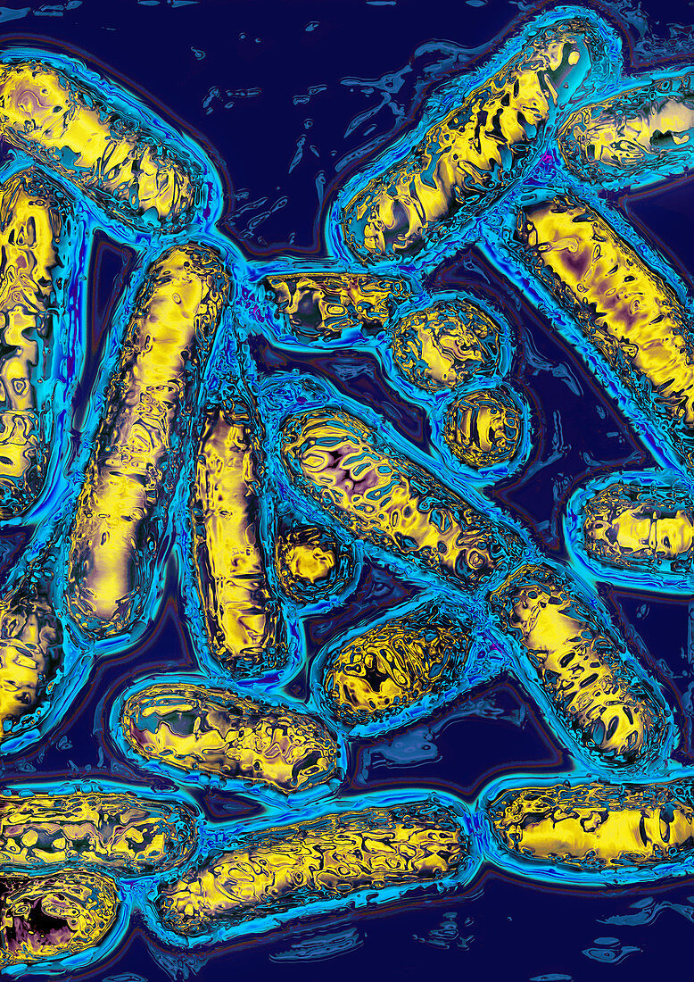 Legionella bacteria,TEM