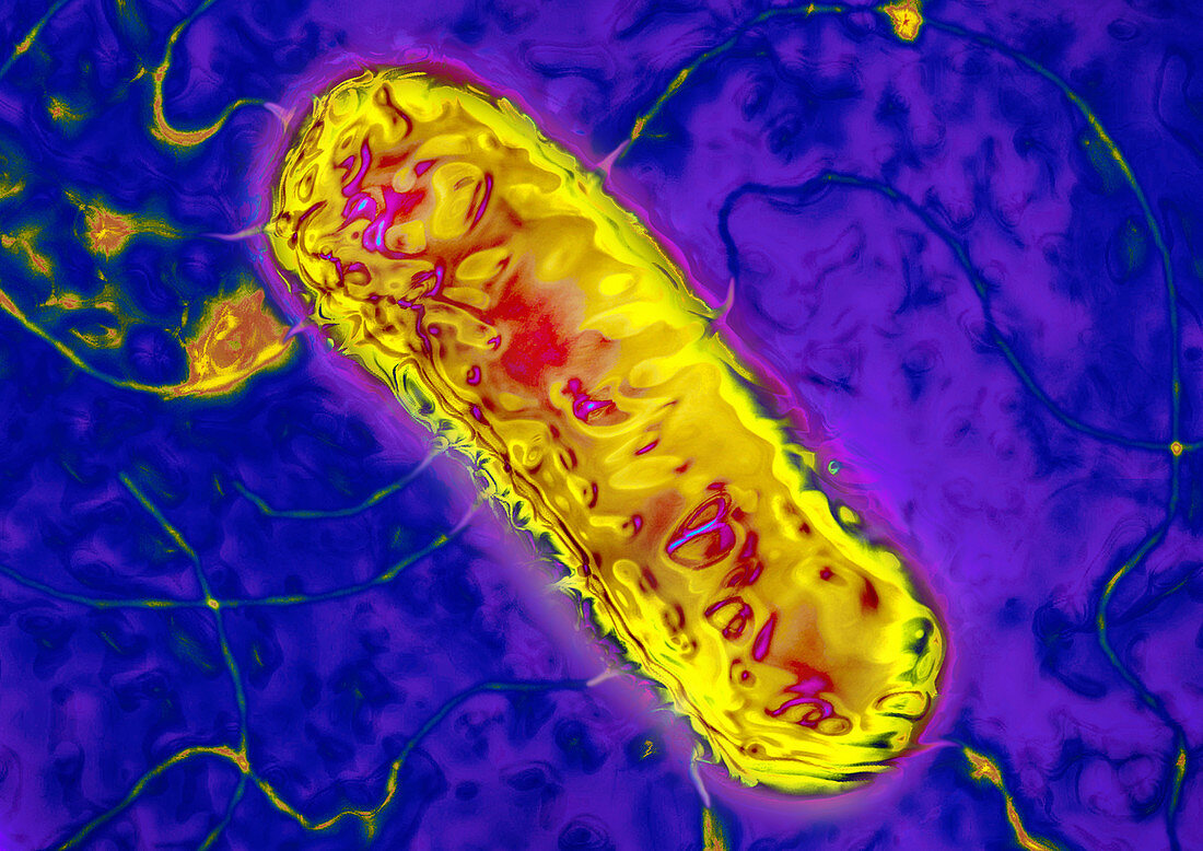 Listeria bacterium,TEM