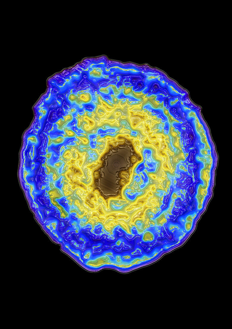 Cytomegalovirus