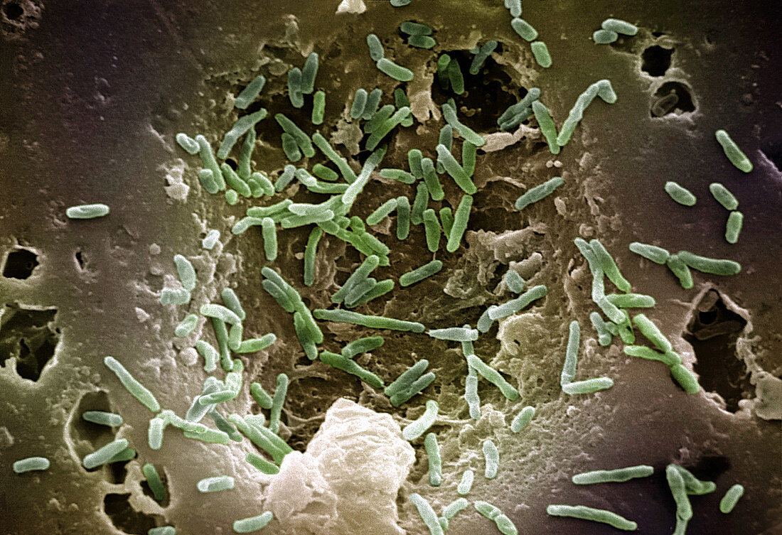 Mycobacterium Chelonae