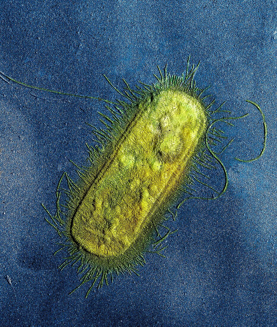 E. coli bacterium,TEM