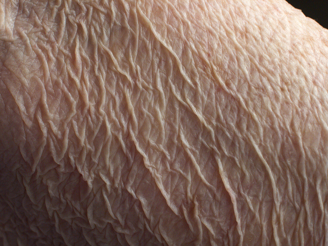 Wrinkly Skin of an Old Woman