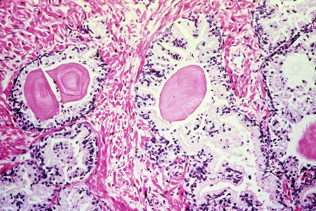 Human Prostate Gland,LM