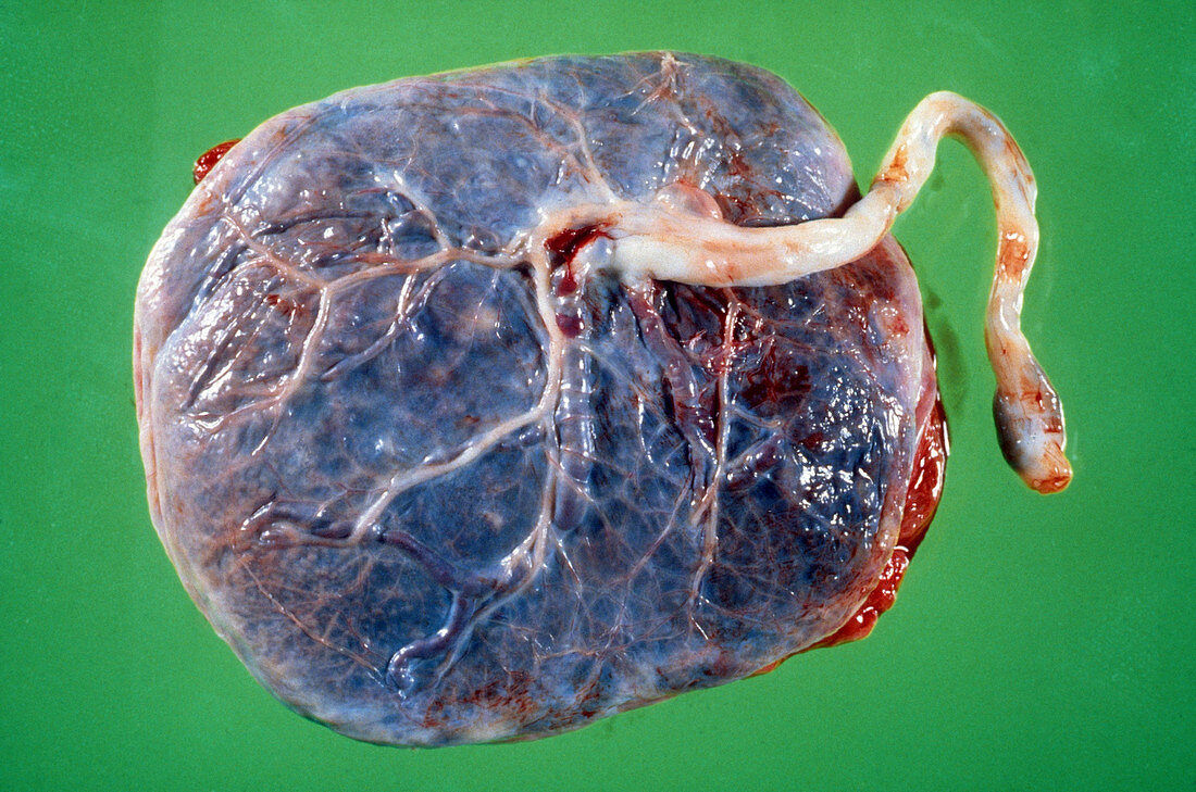 Human Placenta