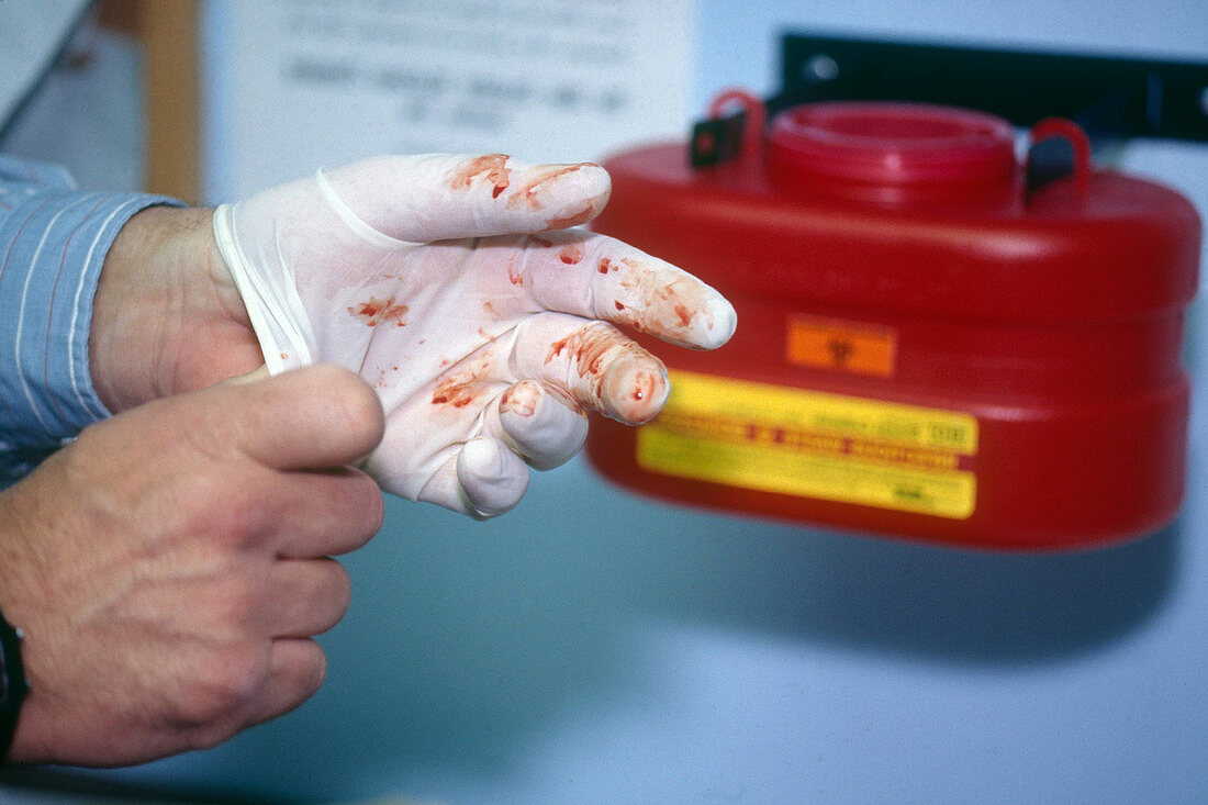 Doctor Removing Glove