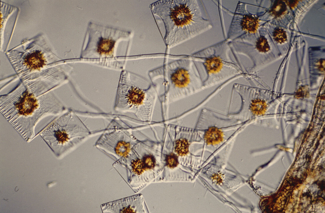 Striatella Diatoms