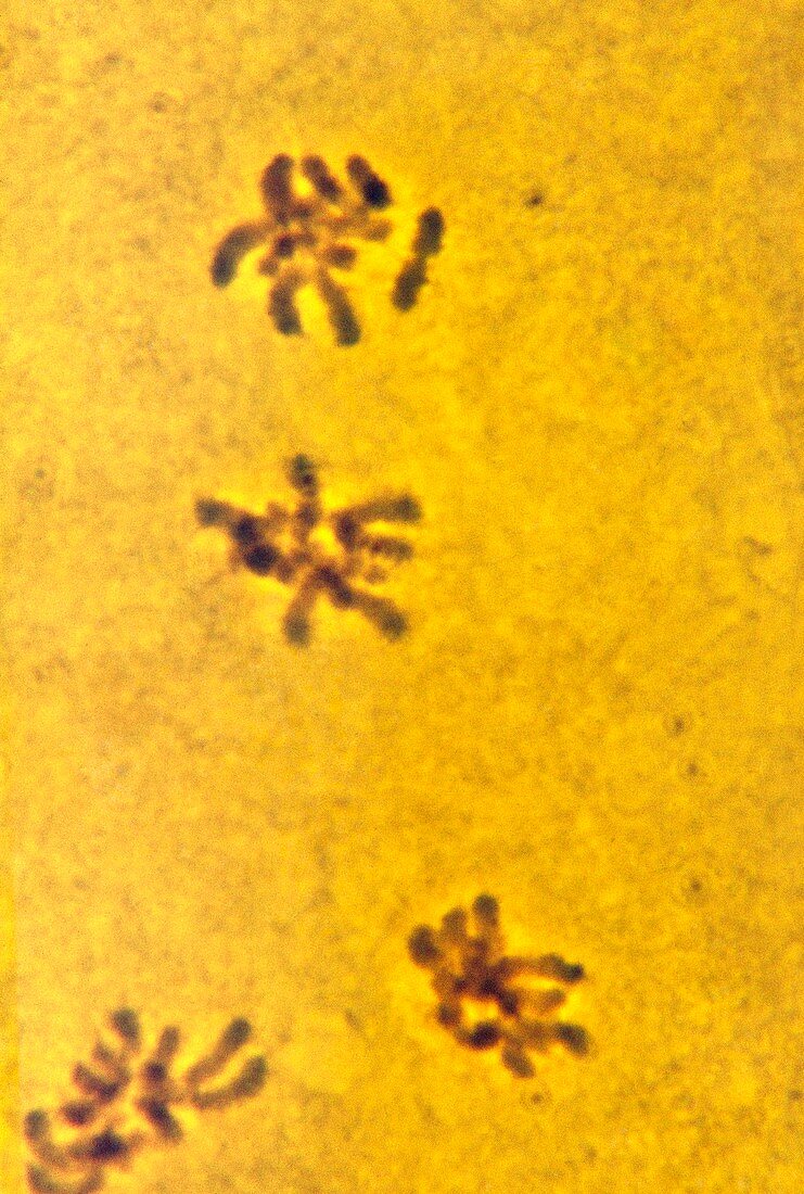 Meiosis,light micrograph