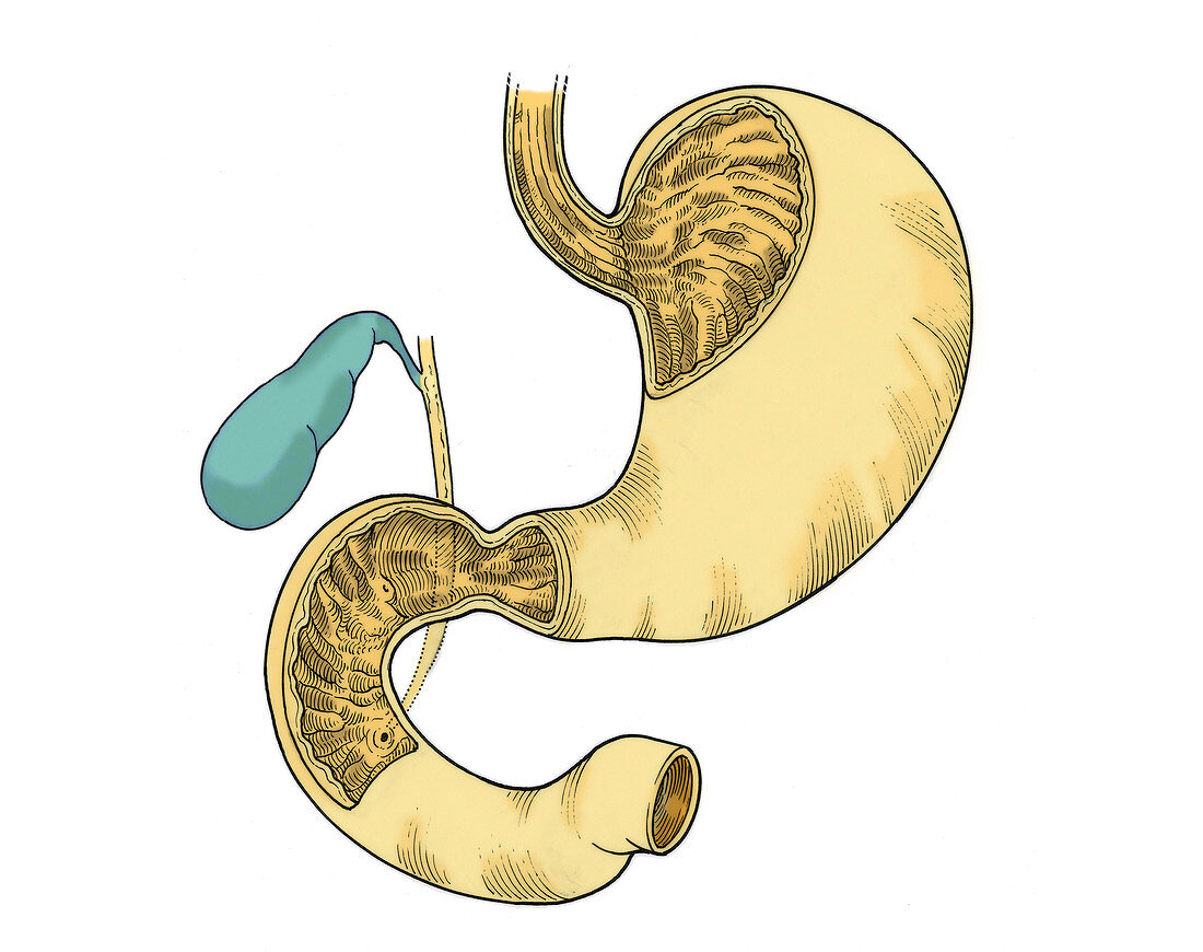 Illustration of Stomach and Duodenum