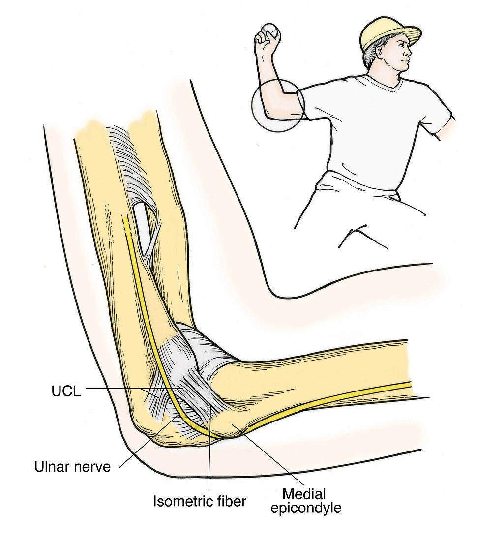 Illustration of Elbow Ligaments