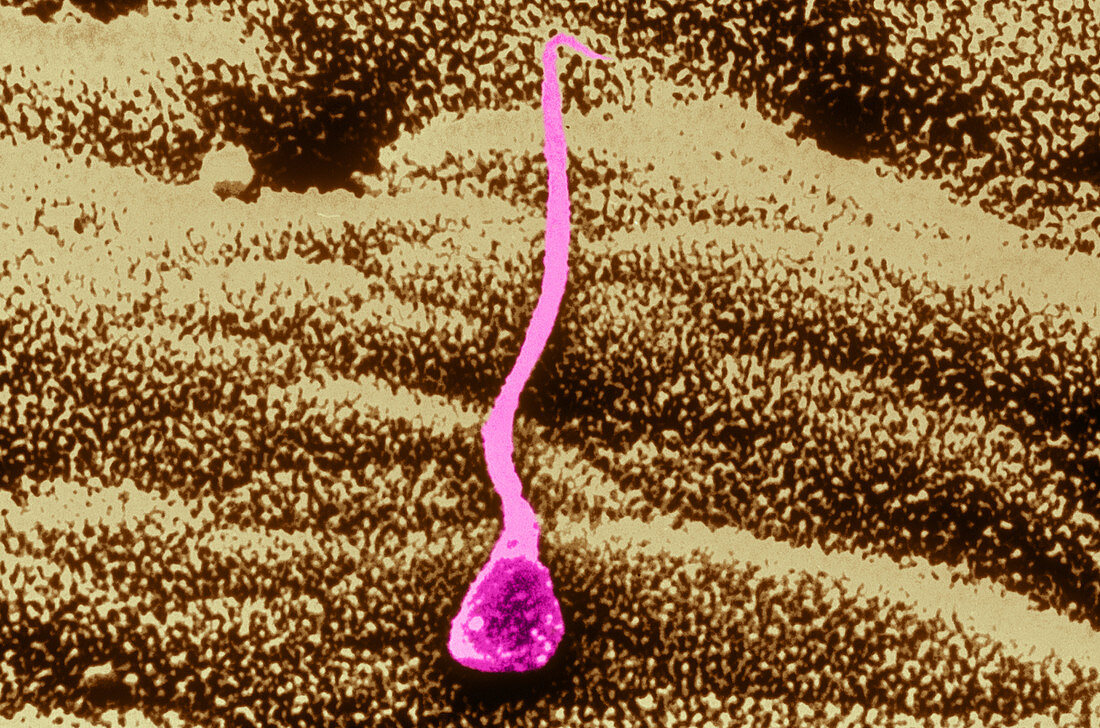 Human sperm in uterus