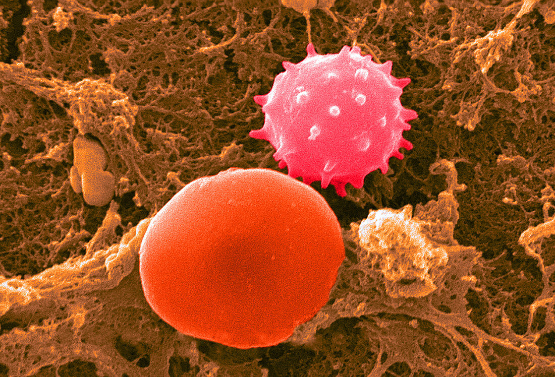 Red and White Blood Cells,SEM