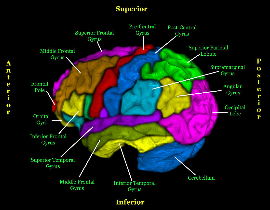 Labelled MRI of Normal Brain