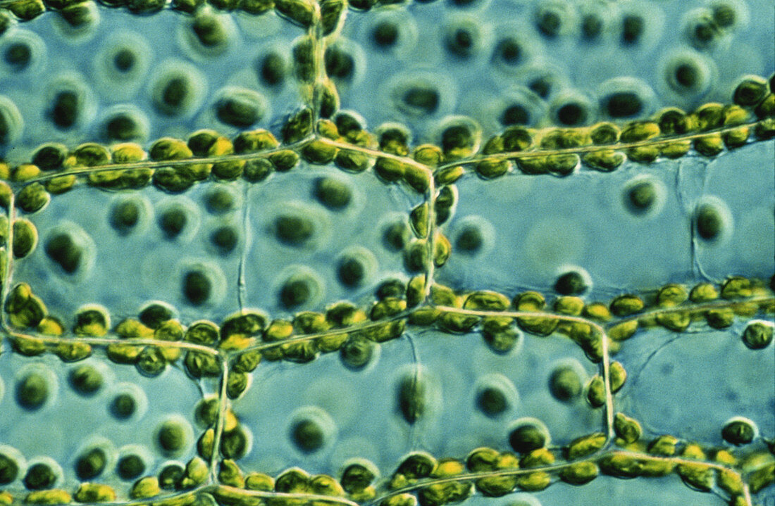 LM of Leaf Cells With Chloroplasts