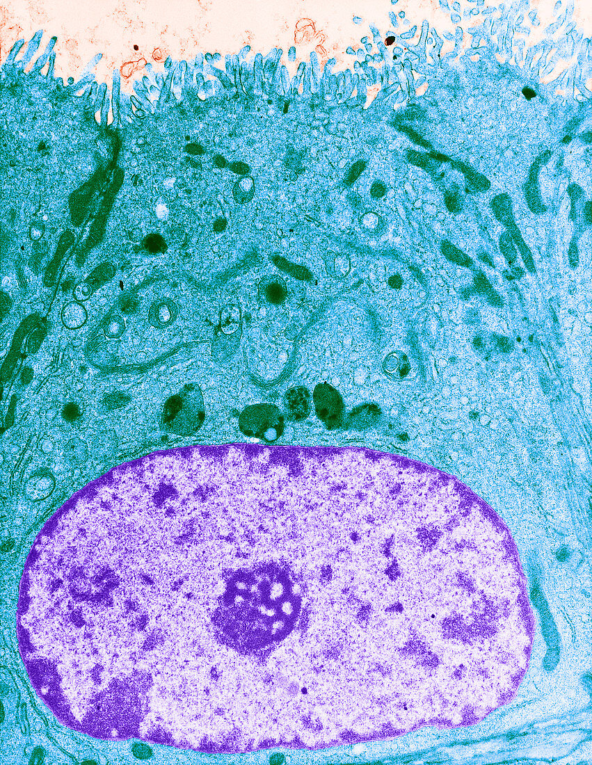 Epithelial Cell,TEM