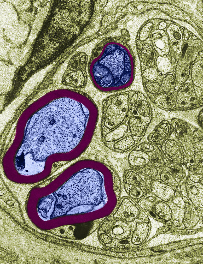 Axons in Rat Cell,TEM