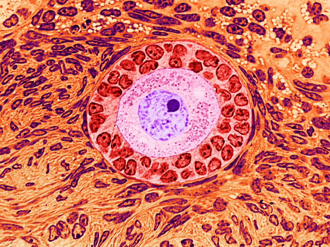 Follicle from Ovary,LM