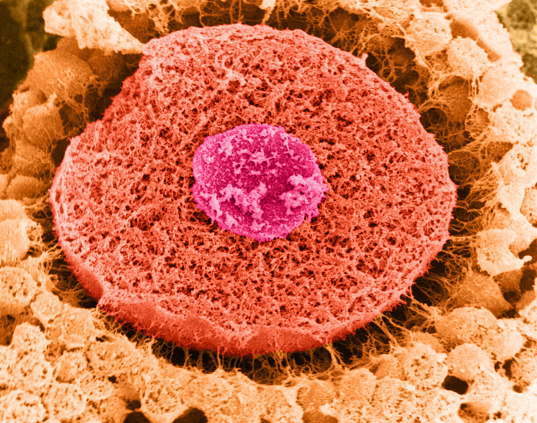 Oocyte Cross Section,SEM