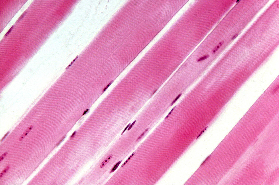 Human Striated Muscle,LM