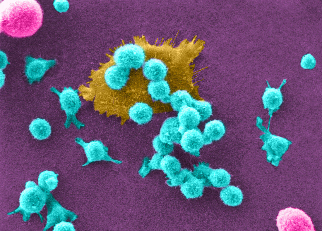 Cancer Cell Death,SEM (2 of 6)