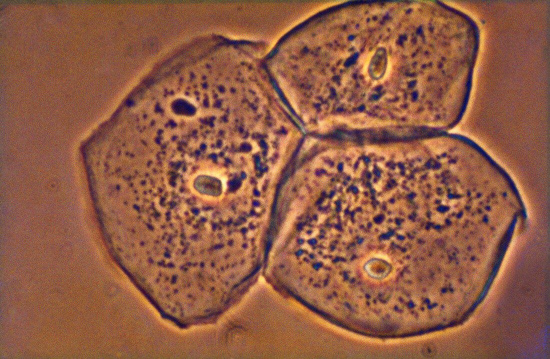 Human cheek cells,light micrograph