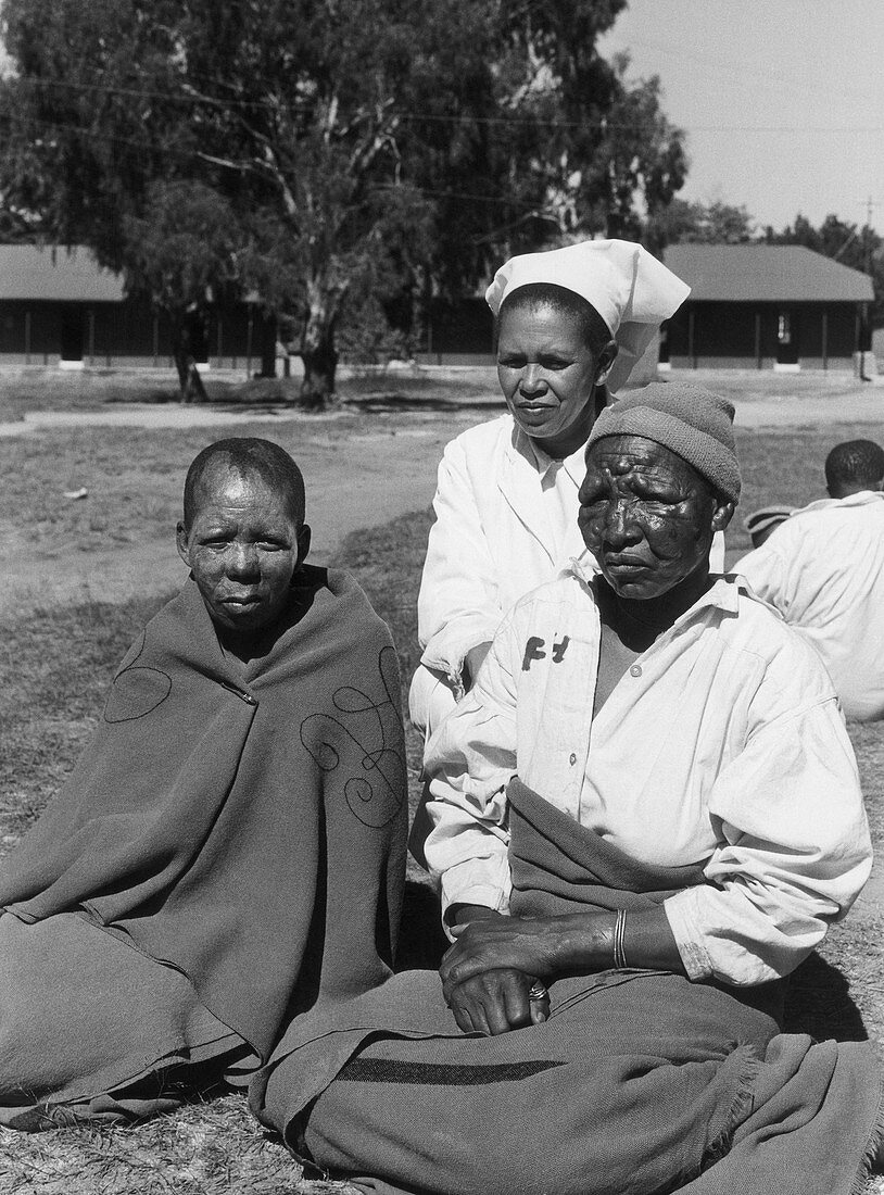 Lepers and Nurse,Lesotho,Africa