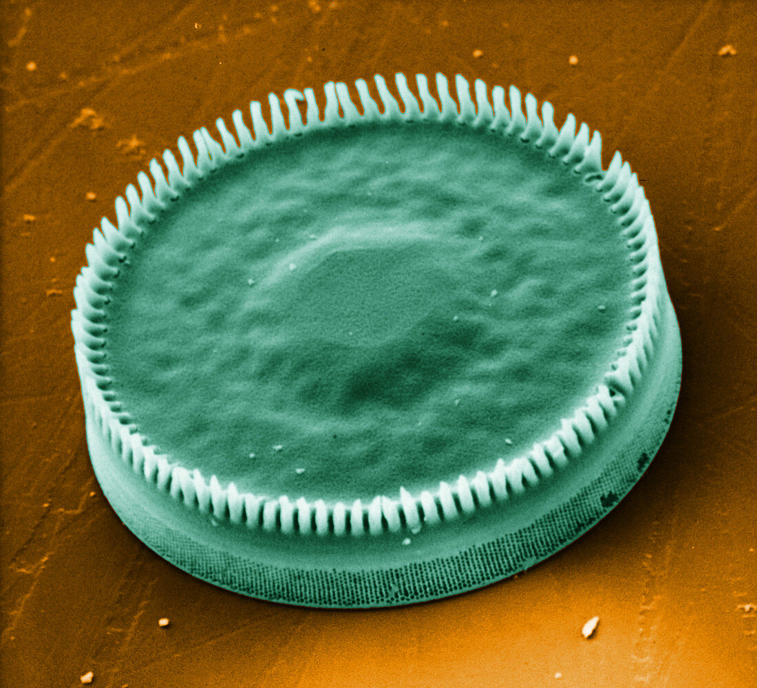 Diatom (Paralia sp.)