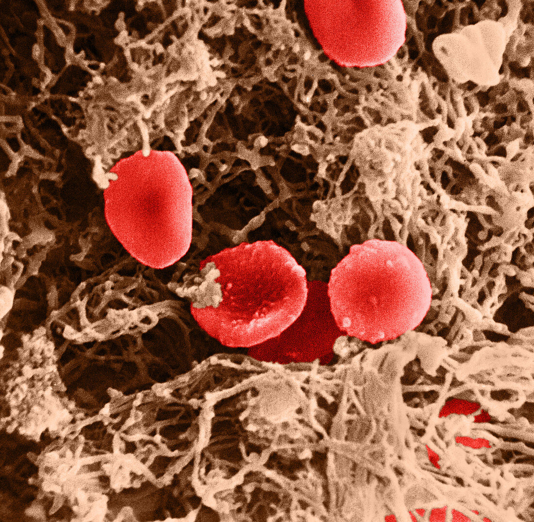 Blood Clot (SEM)