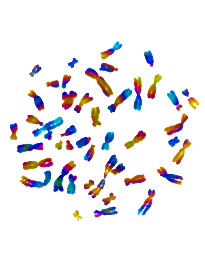 Normal female karyotype