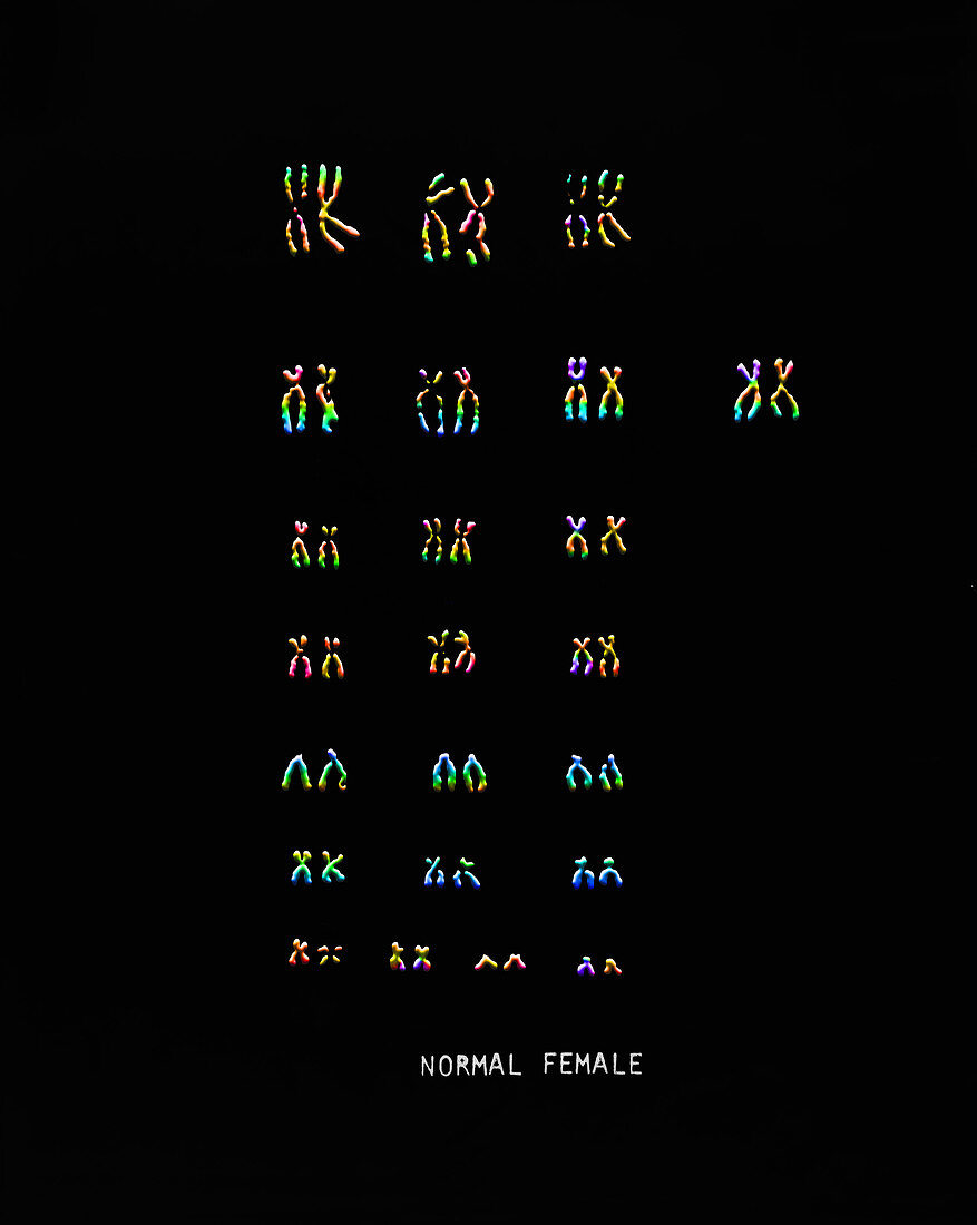 Normal Female Karyotype