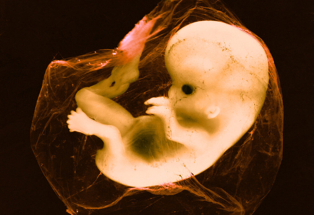 8-Week Human Fetus