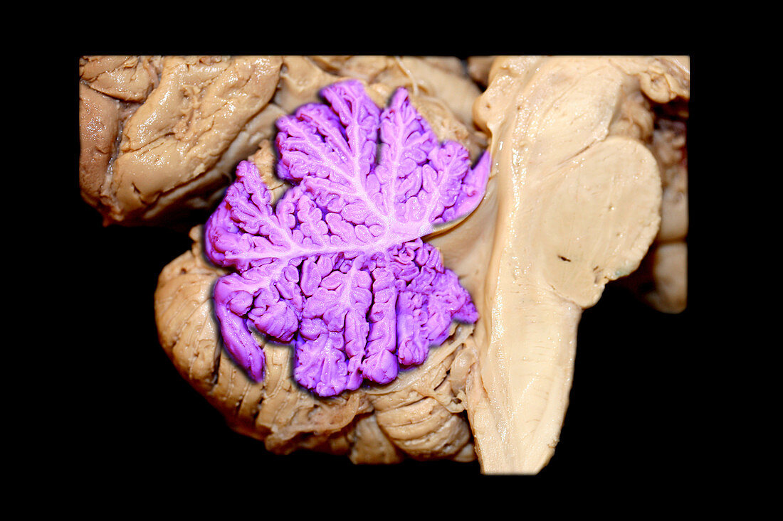 Colour Enhanced Human Cerebellar Vermis