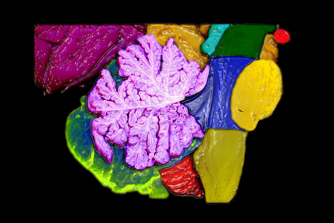 Brainstem,Cerebellum and Occipital Lobe