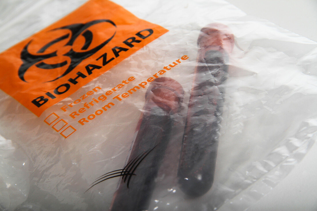 Blood Samples in a Biohazard Bag