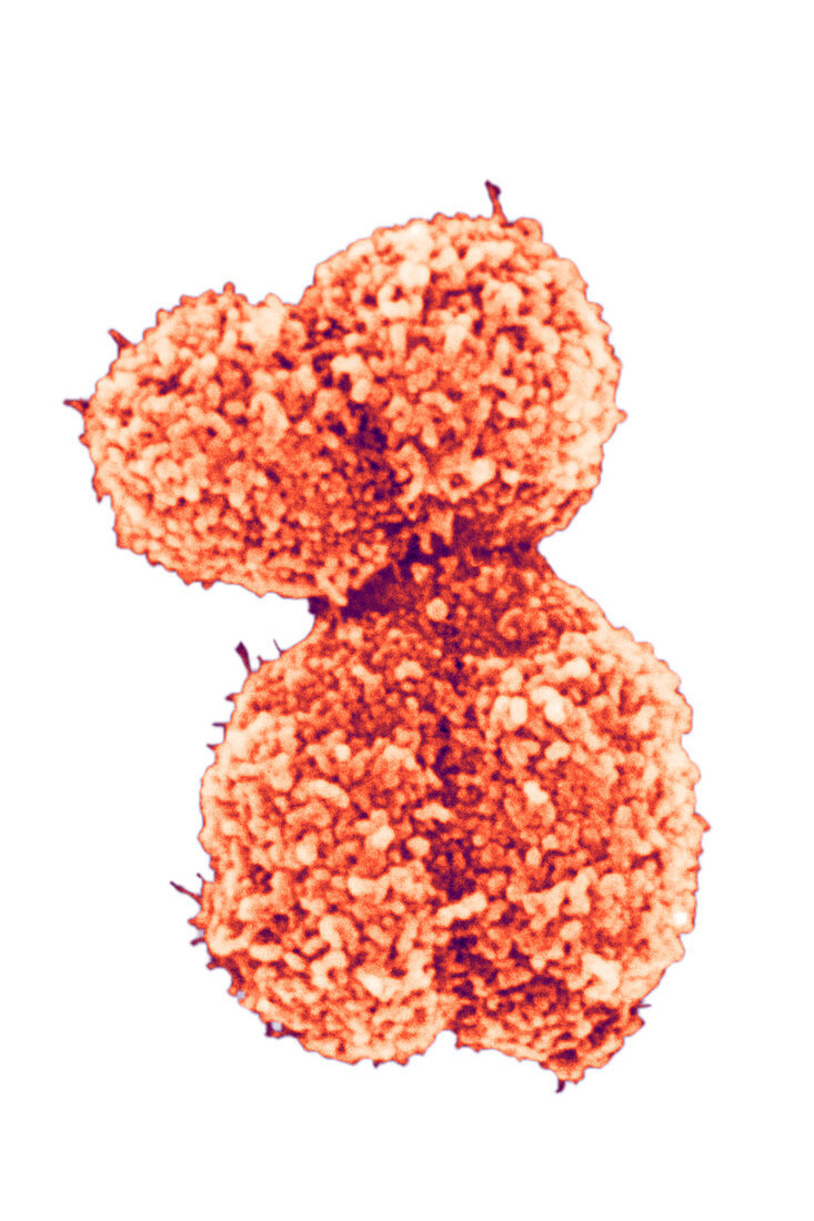 Human Chromosomes in Metaphase,SEM