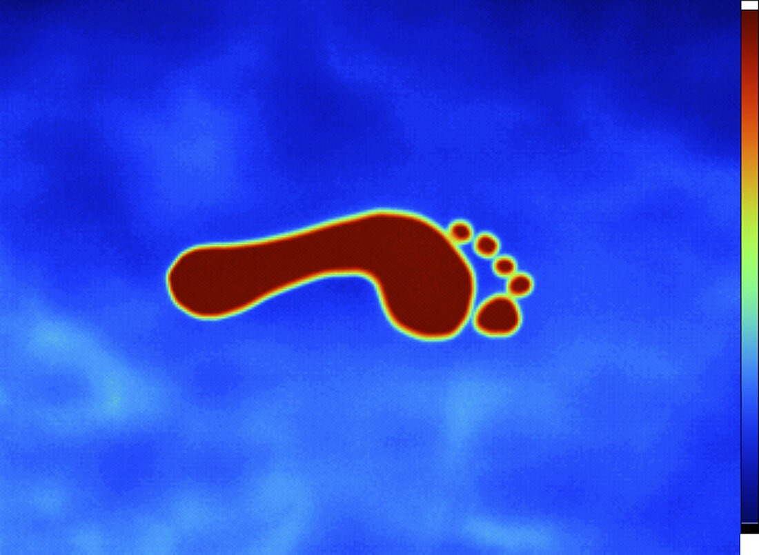 Thermogram of Footprint