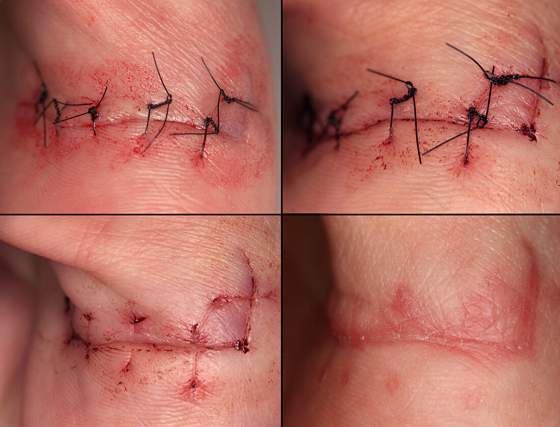 Wound Healing Sequence