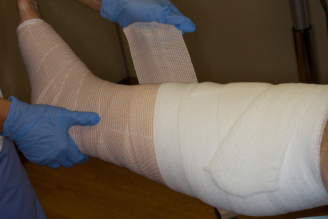 Multiple-layer Compression Dressing