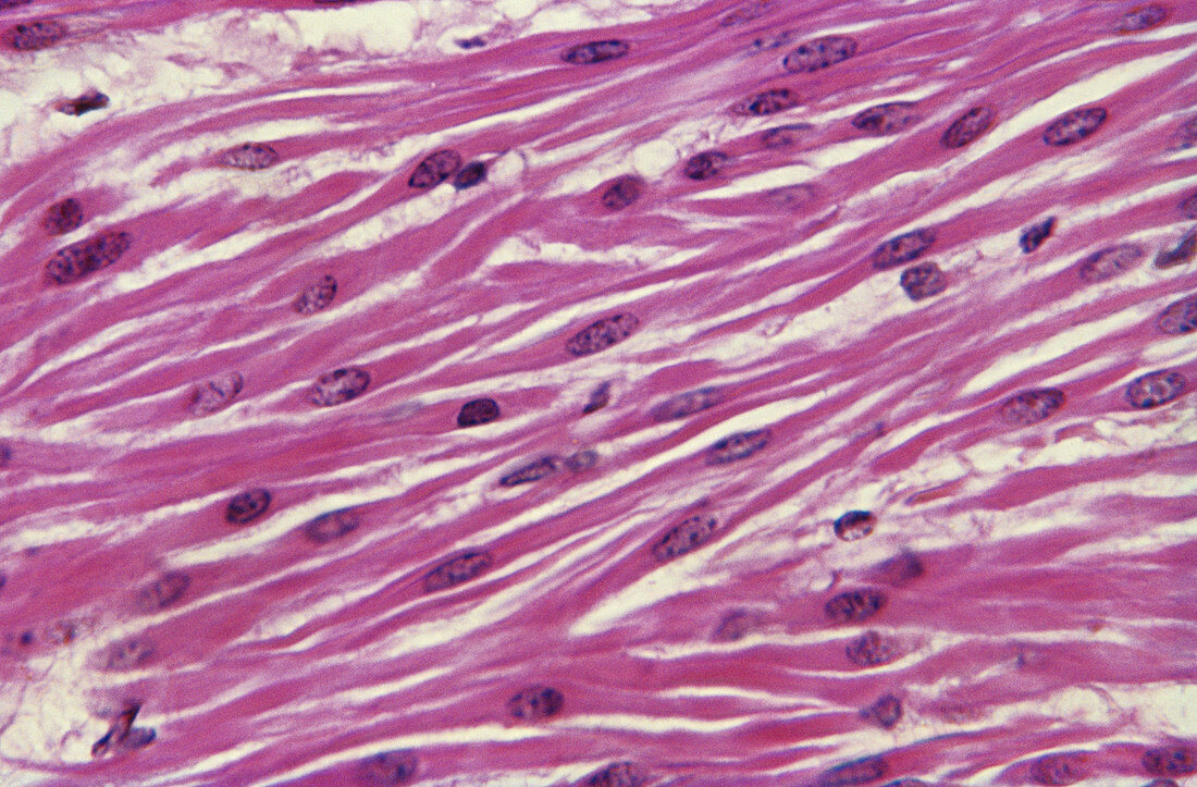 Smooth Muscle (LM)