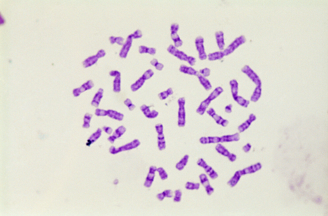 Metaphase Chromosomes (LM)